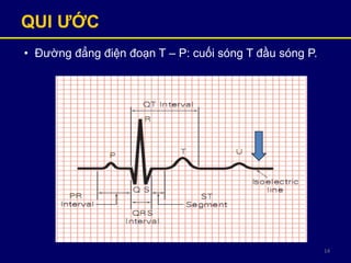14
QUI ƢỚC
• Đường đẳng điện đoạn T – P: cuối sóng T đầu sóng P.
 