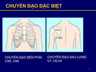 20
CHUYỂN ĐẠO ĐẶC BIỆT
CHUYỂN ĐẠO BÊN PHẢI
V3R, V4R
CHUYỂN ĐẠO SAU LƯNG
V7, V8,V9
 