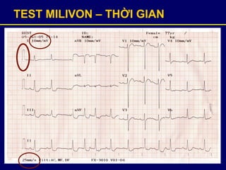 TEST MILIVON – THỜI GIAN
 