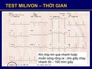 TEST MILIVON – THỜI GIAN
Khi nhịp tim quá nhanh hoặc
muốn sóng rộng ra : cho giấy chạy
nhanh 50 – 100 mm/ giây
 