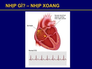 NHỊP GÌ? – NHỊP XOANG
 