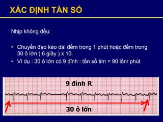 XÁC ĐỊNH TẦN SỐ
Nhịp không đều:
• Chuyển đạo kéo dài đếm trong 1 phút hoặc đếm trong
30 ô lớn ( 6 giây ) x 10.
• Ví dụ : 30 ô lớn có 9 đỉnh : tần số tim = 90 lần/ phút
30 ô lớn
9 đỉnh R
 