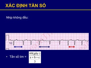 XÁC ĐỊNH TẦN SỐ
Nhịp không đều:
• Tần số tim =
3
cba
)giây(60

 