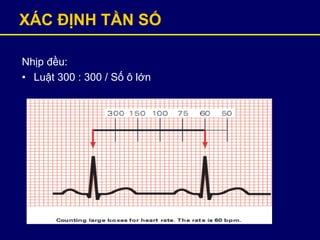 XÁC ĐỊNH TẦN SỐ
Nhịp đều:
• Luật 300 : 300 / Số ô lớn
 