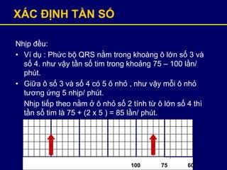 XÁC ĐỊNH TẦN SỐ
Nhịp đều:
• Ví dụ : Phức bộ QRS nằm trong khoàng ô lớn số 3 và
số 4. như vậy tần số tim trong khoảng 75 – 100 lần/
phút.
• Giữa ô số 3 và số 4 có 5 ô nhỏ , như vậy mỗi ô nhỏ
tương ứng 5 nhịp/ phút.
Nhịp tiếp theo nằm ở ô nhỏ số 2 tính từ ô lớn số 4 thì
tần số tim là 75 + (2 x 5 ) = 85 lần/ phút.
100 75 60
 