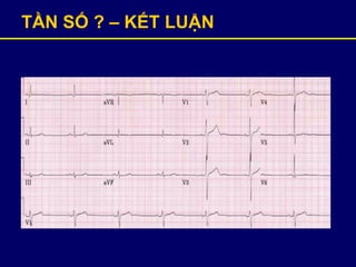 TẦN SỐ ? – KẾT LUẬN
 
