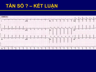 TẦN SỐ ? – KẾT LUẬN
 