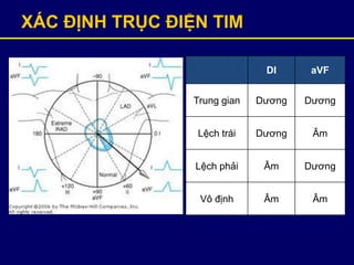 XÁC ĐỊNH TRỤC ĐIỆN TIM
DI aVF
Trung gian Dương Dương
Lệch trái Dương Âm
Lệch phải Âm Dương
Vô định Âm Âm
 