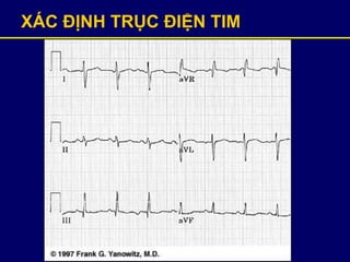 XÁC ĐỊNH TRỤC ĐIỆN TIM
 