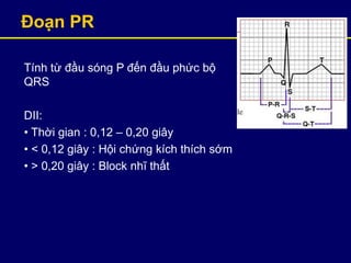 Đoạn PR
Tính từ đầu sóng P đến đầu phức bộ
QRS
DII:
• Thời gian : 0,12 – 0,20 giây
• < 0,12 giây : Hội chứng kích thích sớm
• > 0,20 giây : Block nhĩ thất
 