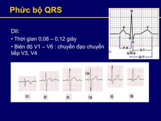 Phức bộ QRS
DII:
• Thời gian 0,08 – 0,12 giây
• Biên độ V1 – V6 : chuyển đạo chuyển
tiếp V3, V4
 