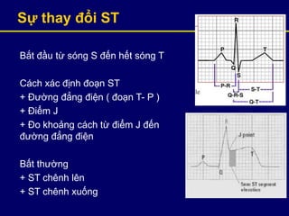 Sự thay đổi ST
Bắt đầu từ sóng S đến hết sóng T
Cách xác định đoạn ST
+ Đường đẳng điện ( đoạn T- P )
+ Điểm J
+ Đo khoảng cách từ điểm J đến
đường đẳng điện
Bất thường
+ ST chênh lên
+ ST chênh xuống
 