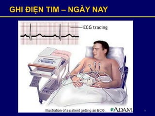 9
GHI ĐIỆN TIM – NGÀY NAY
 