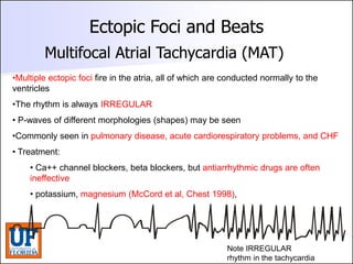 ECG [Compatibility Mode].pdf