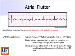 ECG [Compatibility Mode].pdf