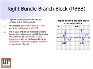 ECG [Compatibility Mode].pdf