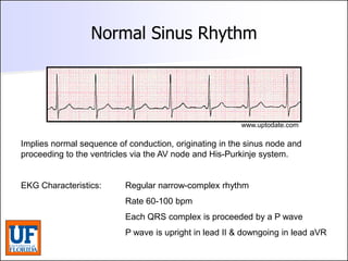 ECG [Compatibility Mode].pdf