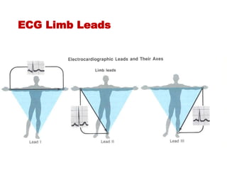 ECG Limb Leads
 