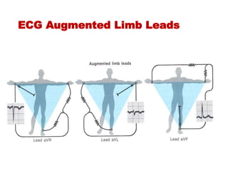 ECG Augmented Limb Leads
 