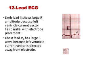 12-Lead ECG
•Limb lead II shows large R
amplitude because left
ventricle current vector
lies parallel with electrode
placement.
•Chest lead V1 has large S
wave because left ventricle
current vector is directed
away from electrode.
 