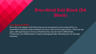 ECG Conduction Abnormalities | PPTX
