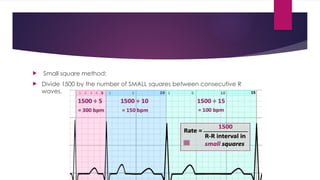 ECG copy.pptx complete guide and under standing basics | PPTX