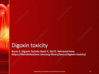 Digoxin toxicity
Burns E. Digoxin Toxicity (April 4, 2017). Retrieved from
https://lifeinthefastlane.com/ecg-library/basics/digoxin-toxicity/
PowerPlugs Templates for PowerPoint Preview 12
 