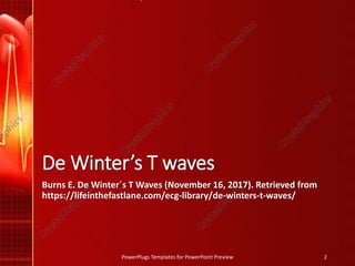 De Winter’s T waves
Burns E. De Winter´s T Waves (November 16, 2017). Retrieved from
https://lifeinthefastlane.com/ecg-library/de-winters-t-waves/
PowerPlugs Templates for PowerPoint Preview 2
 