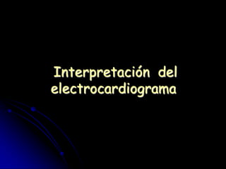 Interpretación del
electrocardiograma
 