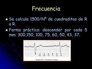 Frecuencia
 Se calcula 1500/Nº de cuadraditos de R
  a R.
 Forma práctica: descender por cada 5
  mm: 300,150, 100, 75, 60, 50, 43, 37.
 