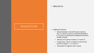 AHA/ACCF/HRS
• QRS≥120 ms
• Additional Features
• Broad notched or slurred R wave in leads I,
aVL, V 5 and V 6, and an occasional RS pattern
in V 5 and V 6 attributed to displaced transition
of QRS complex
• Absence of q waves in leads I, V 5 and V 6
• R peak time > 60 ms in leads V 5 and V 6 but
normal in leads V 1 , V 2 and V 3
• Discordant ST segment and T waves
 