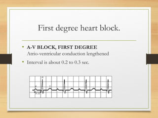 Electrocardiogram ECG Interpretation Cardiac Rhythm | PPTX