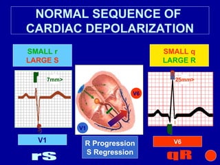 ECG(DIAGNOSTIC TOOLS) learn basics .ppt