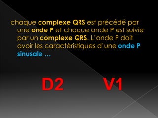 chaque complexe QRS est précédé par
une onde P et chaque onde P est suivie
par un complexe QRS. L’onde P doit
avoir les caractéristiques d’une onde P
sinusale …

D2

V1

 