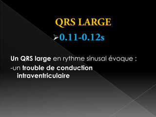 
Un QRS large en rythme sinusal évoque :
-un trouble de conduction
intraventriculaire

 