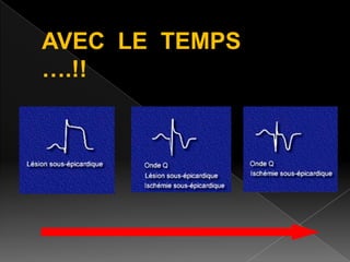 AVEC LE TEMPS
….!!

 