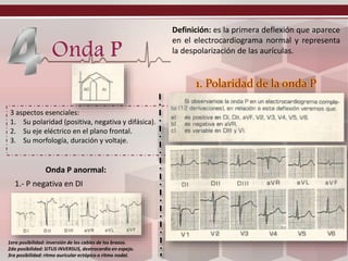 Definición: es la primera deflexión que aparece
en el electrocardiograma normal y representa
la despolarización de las aurículas.
3 aspectos esenciales:
1. Su polaridad (positiva, negativa y difásica).
2. Su eje eléctrico en el plano frontal.
3. Su morfología, duración y voltaje.
1. Polaridad de la onda P
Onda P anormal:
1.- P negativa en DI
1era posibilidad: inversión de los cables de los brazos.
2da posibilidad: SITUS INVERSUS, dextrocardia en espejo.
3ra posibilidad: ritmo auricular ectópico o ritmo nodal.
 