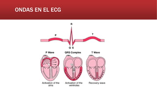 ONDAS EN EL ECG
 