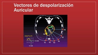 Vectores de despolarización
Auricular
 