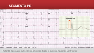 SEGMENTO PR
Retardo fisiologico del estímulo eléctrico desde la auricula hacia los ventrículos
 