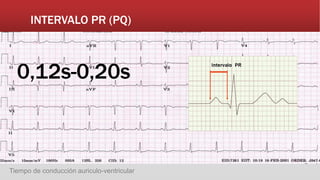 INTERVALO PR (PQ)
Tiempo de conducción auriculo-ventricular
0,12s-0,20s
 