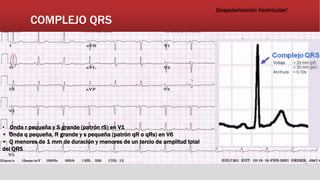 COMPLEJO QRS
Despolarización Ventricular!
• Onda r pequeña y S grande (patrón rS) en V1
• Onda q pequeña, R grande y s pequeña (patrón qR o qRs) en V6
• Q menores de 1 mm de duración y menores de un tercio de amplitud total
del QRS
 