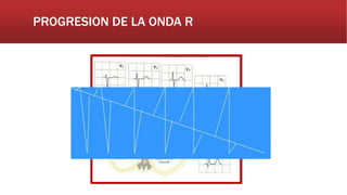 PROGRESION DE LA ONDA R
 