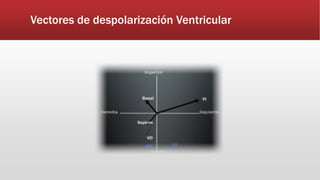 Vectores de despolarización Ventricular
 