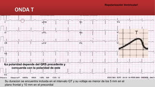 ONDA T
Repolarización Ventricular!
La polaridad depende del QRS precedente y
concuerda con la polaridad de este
Su duracion se encuentra incluida en el intervalo QT y su voltaje es menor de los 5 mm en el
plano frontal y 10 mm en el precordial
 