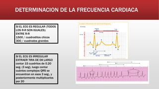 DETERMINACION DE LA FRECUENCIA CARDIACA
SI EL ECG ES REGULAR (TODOS
LOS R-R SON IGUALES):
ENTRE R-R
1500 / cuadraditos chicos
300 / cuadrados grandes
SI EL ECG ES IRREGULAR
EXTRAER TIRA DE DII LARGO
contar 15 cuadritos de 0.20
seg. (3 seg), luego contar
cuántos complejos QRS se
encuentran en esos 3 seg., y
posteriormente multiplicarlos
por 20
 