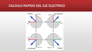 CALCULO RAPIDO DEL EJE ELECTRICO
 
