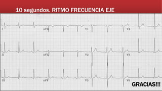 10 segundos. RITMO FRECUENCIA EJE
GRACIAS!!!
 