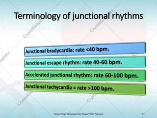 Terminology of junctional rhythms
PowerPlugs Templates for PowerPoint Preview 11
 
