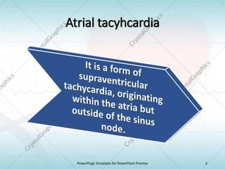 Atrial tacyhcardia
PowerPlugs Templates for PowerPoint Preview 3
 